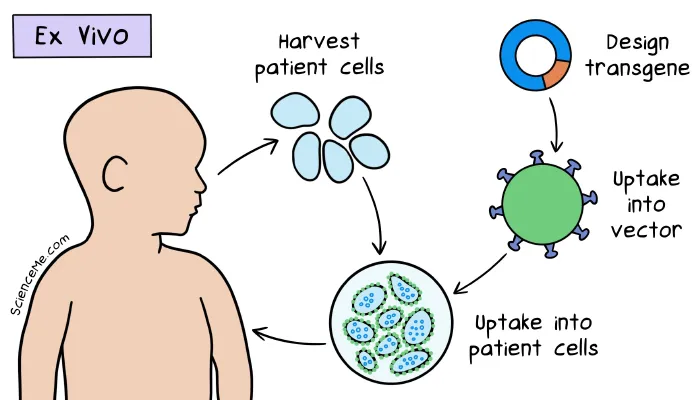 Gene therapy explained: illustration of viral vector transporting transgenes into cells ex vivo