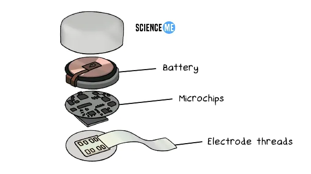 What is Neuralink